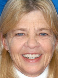 Woman smiling brightly against blue background, professional headshot for dental care website.