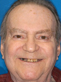 Middle-aged man smiling at camera against blue background, dental care portrait.