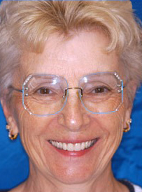 Smiling woman wearing glasses against blue background, dental practice portrait