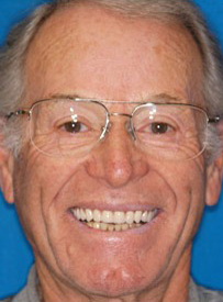 Smiling older man wearing glasses against blue background, dental care professional portrait