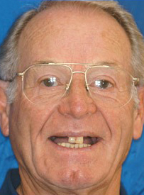 Older man wearing glasses smiling at camera against blue background, dental professional portrait.