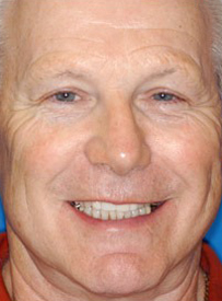 Smiling middle-aged man displaying healthy teeth in dental office portrait