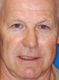 Middle-aged man smiling at camera against blue background, dental care portrait.