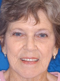 Senior woman smiling at camera against blue background, professional headshot for dental care practice.
