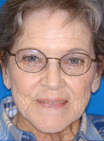 Elderly woman wearing glasses smiling at camera against blue background, dental care portrait.