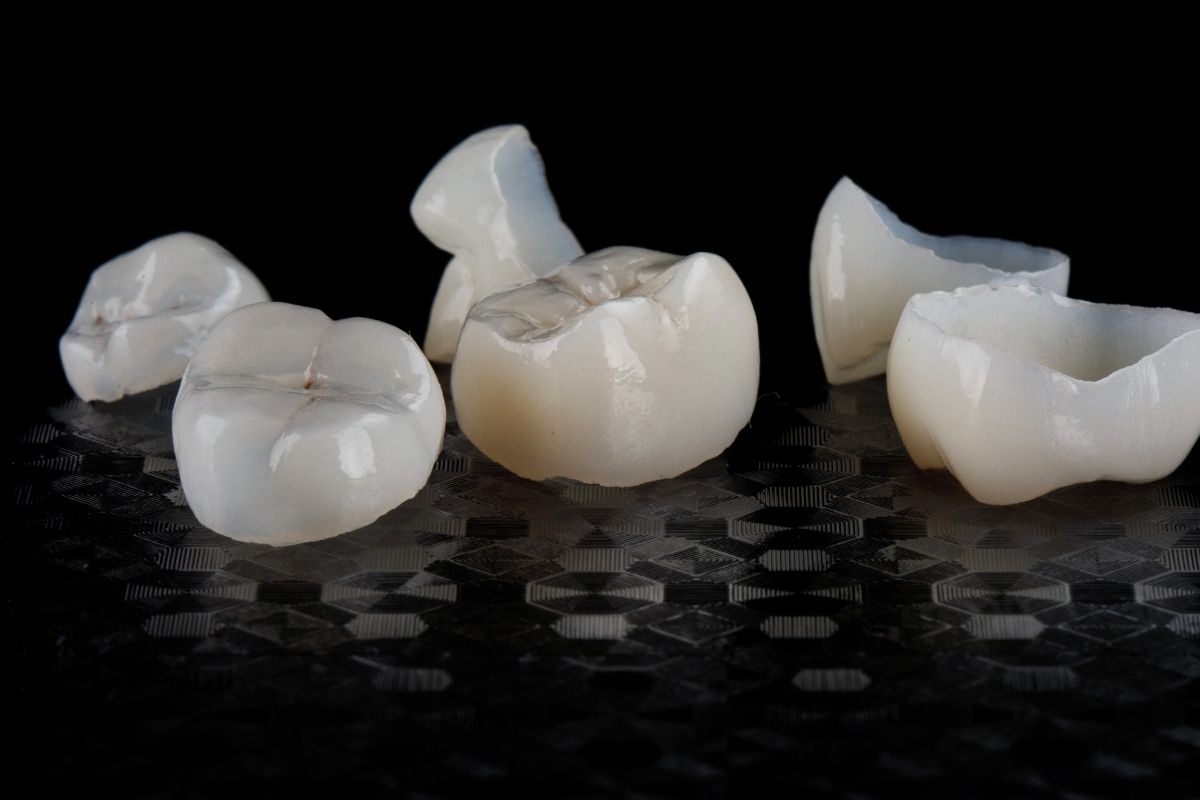 types of dental crowns