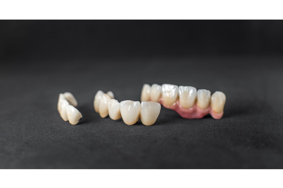 dental Crown Falls Out