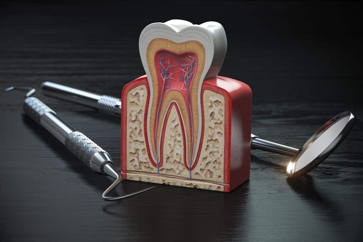Tooth cross-section diagram showing pulp, blood vessels, and nerve canals with dental instruments.